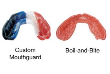 custom mouth guard vs boil and bite