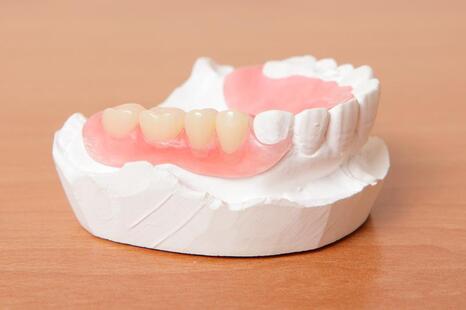 denture partial