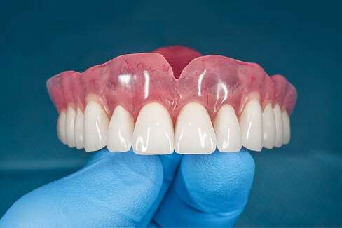 dentures upper front