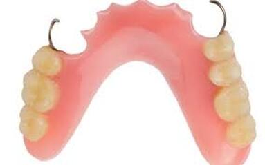 partial denture