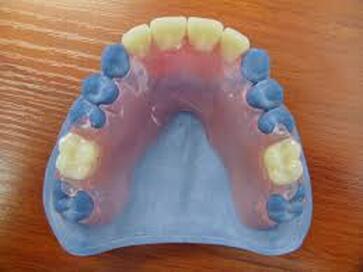 partial denture model