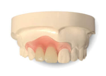 partial denture repair model